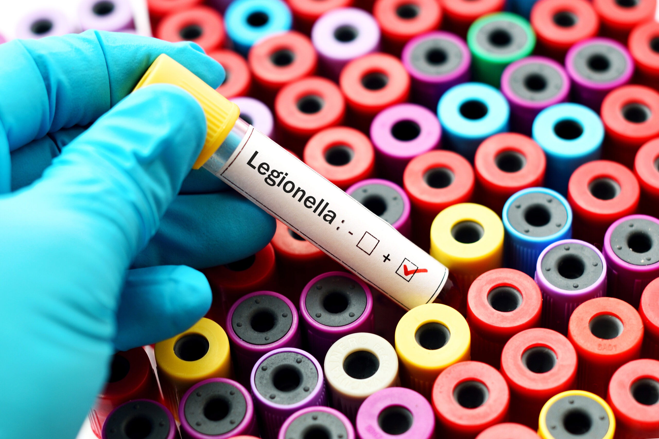 Legionella Risk Assessment and Water Treatment Solutions